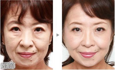 專家(jiā)為(wèi)你(nǐ)介紹重慶愛德華醫院有限公司整形的(de)相(xiàng)關內(nèi)容